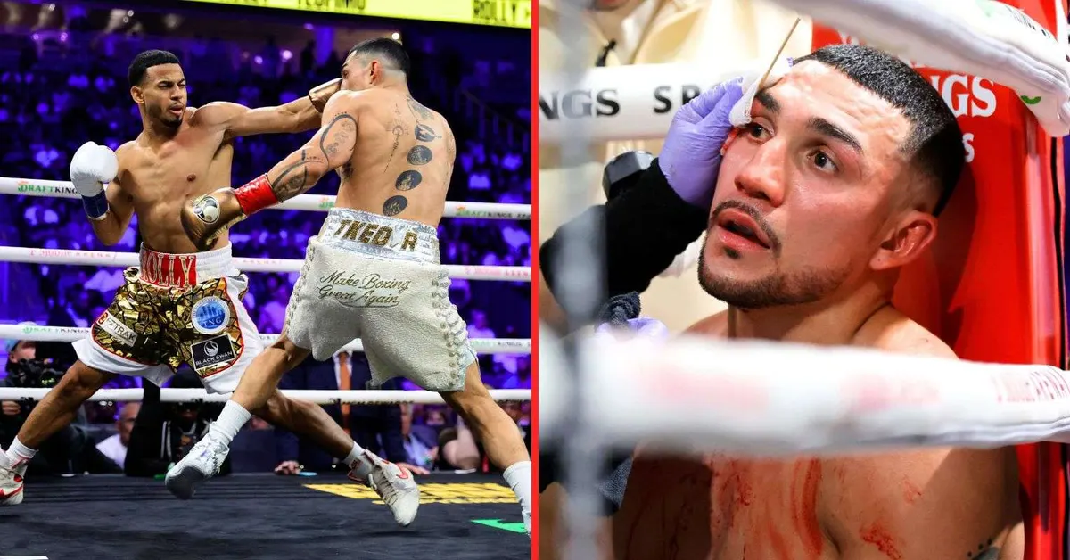 Lopez calls Romero welterweight's biggest puncher after 116-112 win